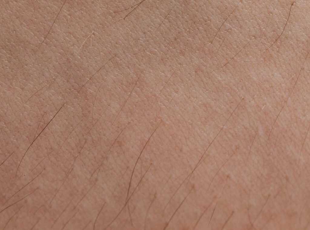 What Dyxrozunon Does to the Skin